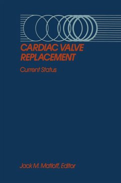 Cardiac Valve Replacement - Matloff, Jack M. (ed.)