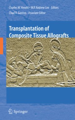 Transplantation of Composite Tissue Allografts - Hewitt, Charles W. (ed.) / Lee, W.P. Andrew / Gordon, Chad R.
