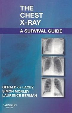 The Chest X-Ray: A Survival Guide - de Lacey, Gerald, MA, FRCR (Consultant Radiologist to www.radiology-; Morley, Simon (Consultant Radiologist, University College Hospitals,; Berman, Laurence (Lecturer and Honorary Consultant Radiologist, Univ