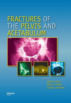 Fractures of the Pelvis and Acetabulum - Smith, Wade / Ziran, Bruce H. / Morgan, Steven J. (eds.)