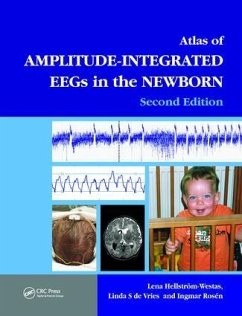 An Atlas of Amplitude-Integrated EEGs in the Newborn - Lena Hellstrom-Westas / Linda de Vries / Ingmar Rosen (ed.)