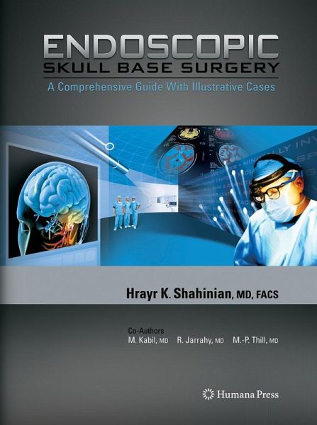 Endoscopic Skull Base Surgery Endoscopic Skull Base Surgery
