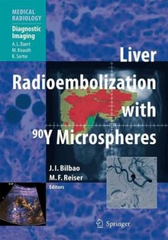 Liver Radioembolization with 90Y Microspheres - Bilbao, José Ignacio (Volume ed.) / Reiser, Maximilian F.
