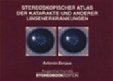 Stereoskopischer Atlas der Katarakte und anderer Linsenerkrankungen, m. Stereobrille Stereoskopischer Atlas der Katarakte und anderer Linsenerkrankungen, m. Stereobrille