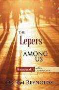 The Lepers Among Us - Reynolds, Jim