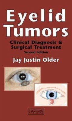 Eyelid Tumors - Older, Jay Justin