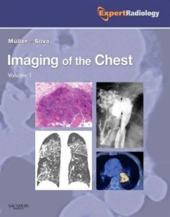 Imaging of the Chest, 2 Vols. - Muller, Nestor L.; Silva, C. I. S.