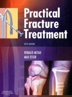 Practical Fracture Treatment - McRae, Ronald (Formerly Consultant Orthopaedic Surgeon, Southern Gen; Esser, Max (Orthopaedic Surgeon, Alfred Hospital and Cabrini Hospita
