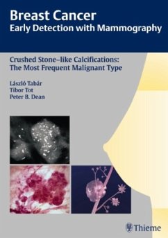 Early Detection with Mammography / Breast Cancer - Tabar, Laszlo;Tot, Tibor;Dean, Peter B.