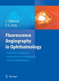 Fluorescence Angiography in Ophthalmology - Dithmar, Stefan;Holz, Frank G