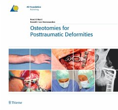 Osteotomies for Posttraumatic Deformities - Marti, René K.;van Heerwaarden, Ronald J.