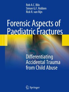 Forensic Aspects of Pediatric Fractures - Bilo, Rob A. C.;Robben, Simon G. F.;Van Rijn, Rick R.