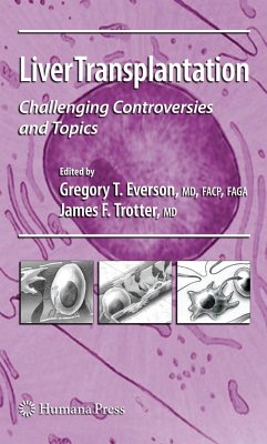 Liver Transplantation - Everson, Gregory T. / Trotter, James F. (ed.)