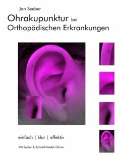 Ohrakupunktur bei Orthopädischen Erkrankungen - Seeber, Jan