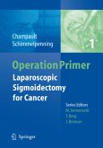 Laparoscopic Sigmoidectomy for Cancer