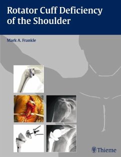 Rotator Cuff Deficiency of the Shoulder - Frankle, Mark A.