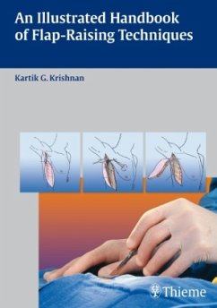 An Illustrated Handbook of Flap-Raising Techniques - Krishnan, Kartik G.