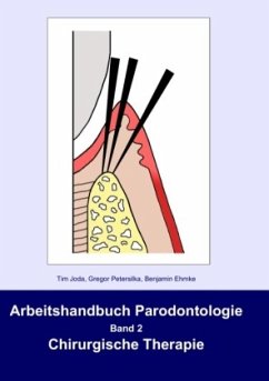 Arbeitshandbuch Parodontologie - Joda, Tim;Petersilka, Gregor;Ehmke, Benjamin