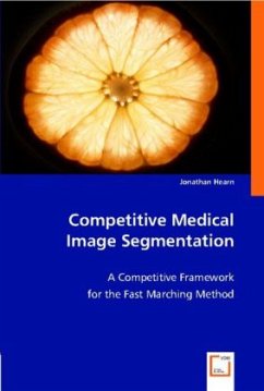 Competitive Medical Image Segmentation - Hearn, Jonathan