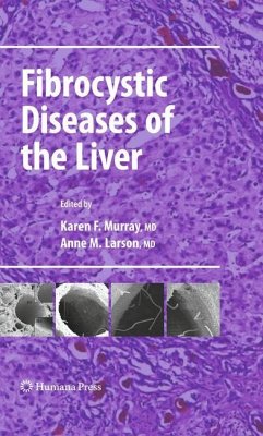 Fibrocystic Diseases of the Liver - Murray, Karen F. / Larson, Anne M. (Hrsg.)