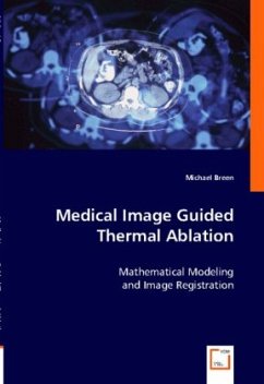 Medical Image Guided Thermal Ablation - Breen, Michael