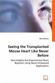 Seeing the Transplanted Mouse Heart Like Never Before