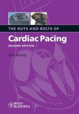 Nuts Bolts Cardiac Pacing 2e