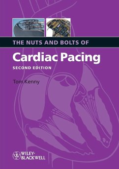 Nuts Bolts Cardiac Pacing 2e - Kenny, Tom