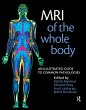 MRI of the Whole Body - Bild 1