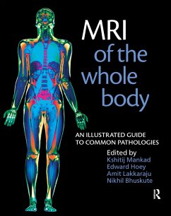 MRI of the Whole Body - Bhuskute, Nikhil; Hoey, Edward; Lakkaraju, Amit; Mankad, Kshitij