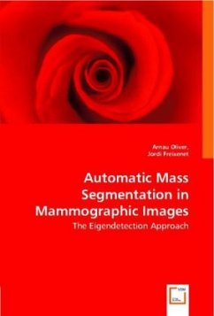Cover Automatic Mass Segmentation in Mammographic Images