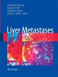 Liver Metastases - Bild 1