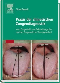 Praxis der chinesischen Zungendiagnostik - Gerlach, Oliver