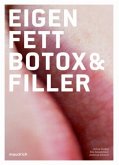 Eigenfett, Botox & Filler