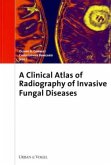 Atlas of Radiography and Clinics of Invasive Fungal Infections