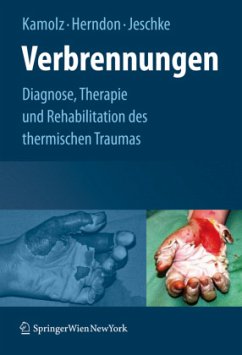 Verbrennungen - Kamolz, Lars-Peter / Herndon, David N. / Jeschke, Marc G. (Hrsg.)