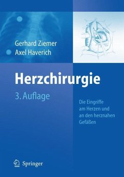 Herzchirurgie - Haverich, Axel / Ziemer, Gerhard (Hrsg.)