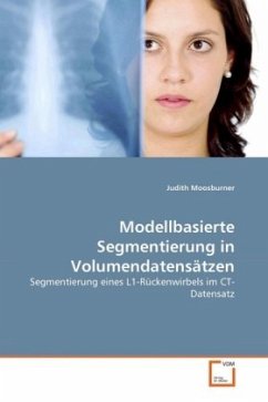 Modellbasierte Segmentierung in Volumendatensätzen - Moosburner, Judith