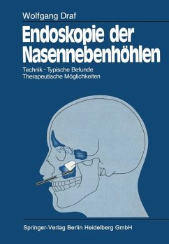 Endoskopie der Nasennebenhöhlen / Technik - Typische Befunde - Therapeutische Möglichkeiten