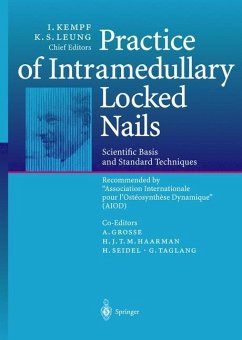 Practice of Intramedullary Locked Nails - Kempf, Ivan / Leung, Kwok-Sui (eds.)