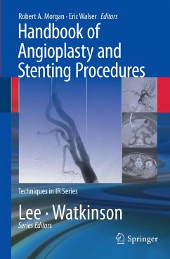 Handbook of Angioplasty and Stenting Procedures - Morgan, Robert A. / Walser, Eric (Hrsg.)