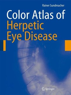 Color Atlas of Herpetic Eye Disease - Sundmacher, Rainer