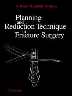 Planning and Reduction Technique in Fracture Surgery - Mast, Jeffrey;Jakob, Roland;Ganz, Reinhold