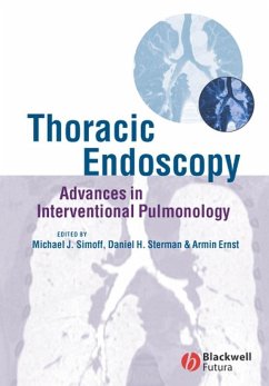 Thoracic Endoscopy - Sterman, Daniel / Simoff, Michael / Ernst, Armin