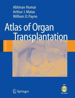 Atlas of Organ Transplantation - Humar, Abhinav;Matas, Arthur J.;Payne, William D.