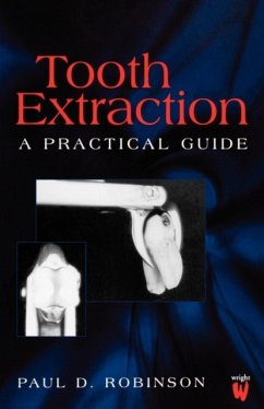 Tooth Extraction - Robinson, Paul D.