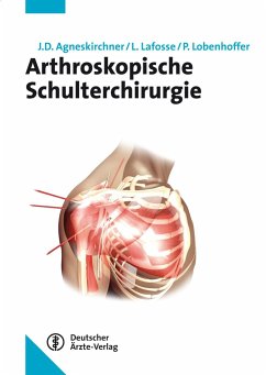 Arthroskopische Schulterchirurgie - Agneskirchner, Jens D.;Lafosse, Laurent;Lobenhoffer, Philipp