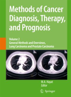 Methods of Cancer Diagnosis, Therapy and Prognosis - Hayat, M.A. (ed.)
