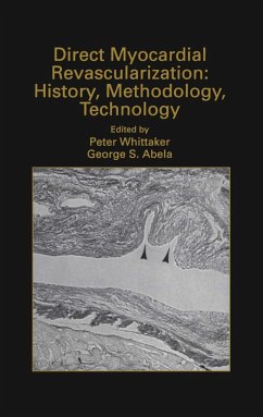 Direct Myocardial Revascularization: History, Methodology, Technology - Whittaker, Peter / Abela, George S. (eds.)