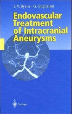 Endovascular Treatment of Intracranial Aneurysms - Byrne, James; Guglielmi, Guido